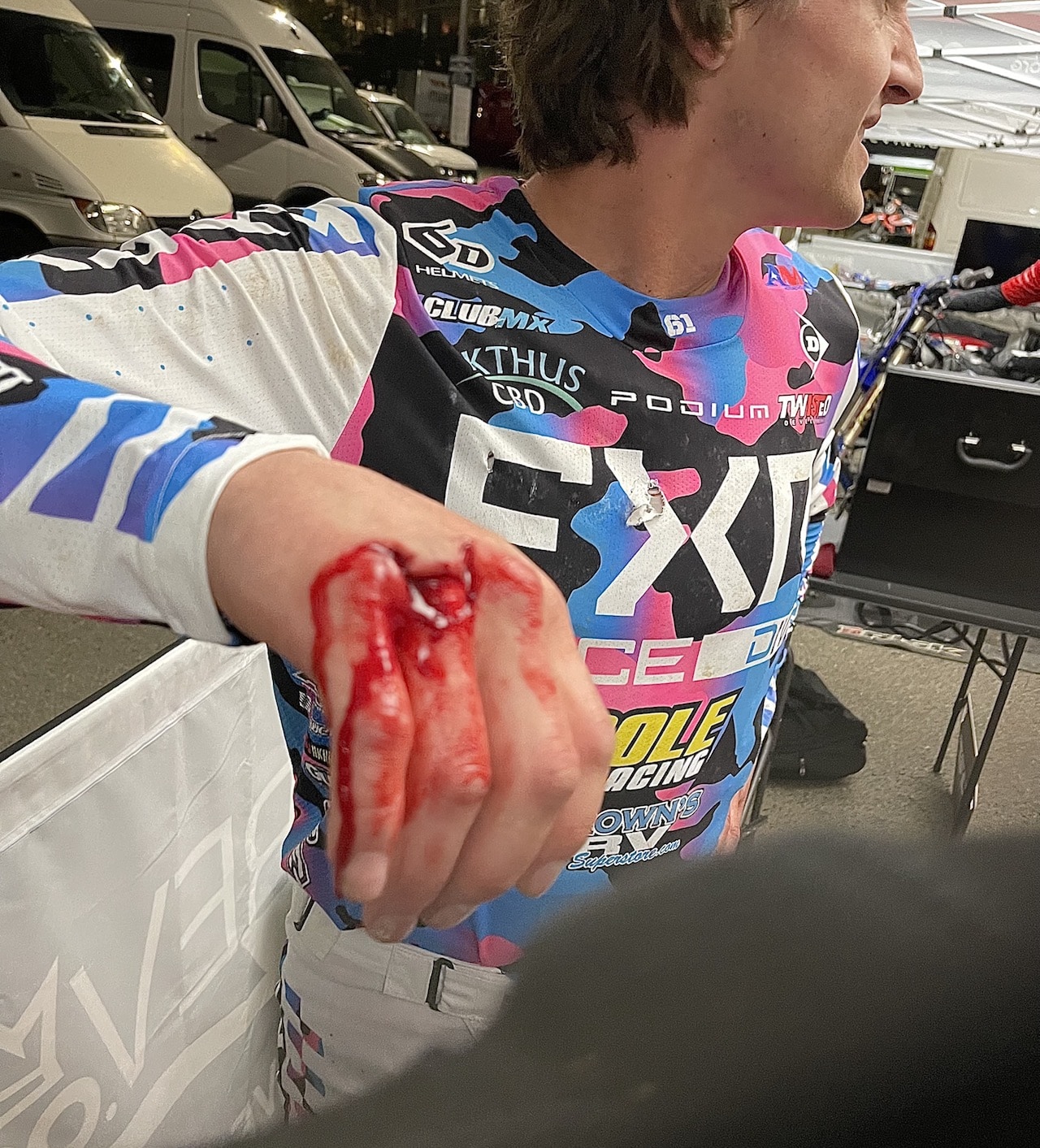 Freddie Noren zraněná ruka 2022 San Diego Supercross